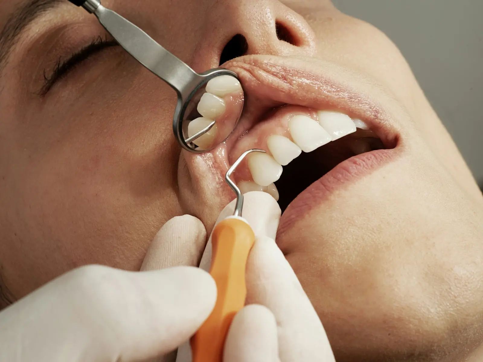 A patient during a dental exam